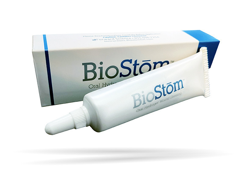 Biostom BioStōm Launch | Forward Science